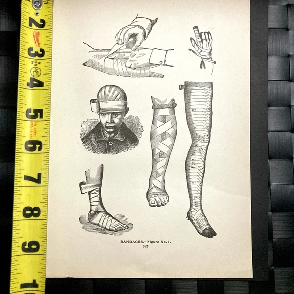 Vintage Medical Diagram | Bandages | Circa 1903 - Picture 4 of 6
